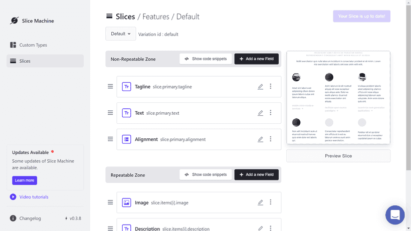 Slice Machine of Prismic
